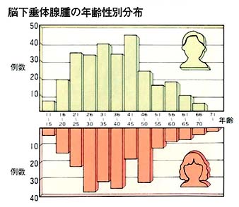 脳下垂体腺腫の年齢性別分布