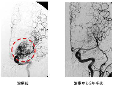 avm_slide4