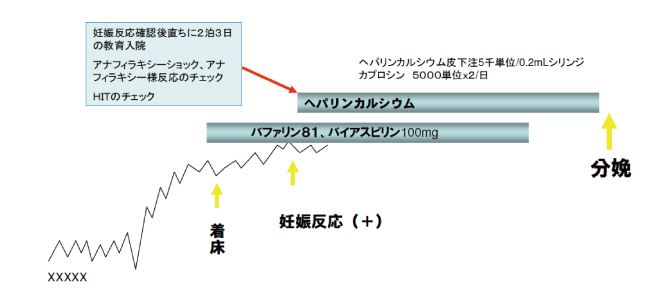 ヘパリン療法治療法