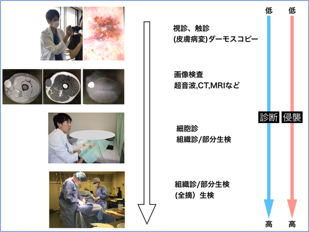 皮膚がんの診断1205