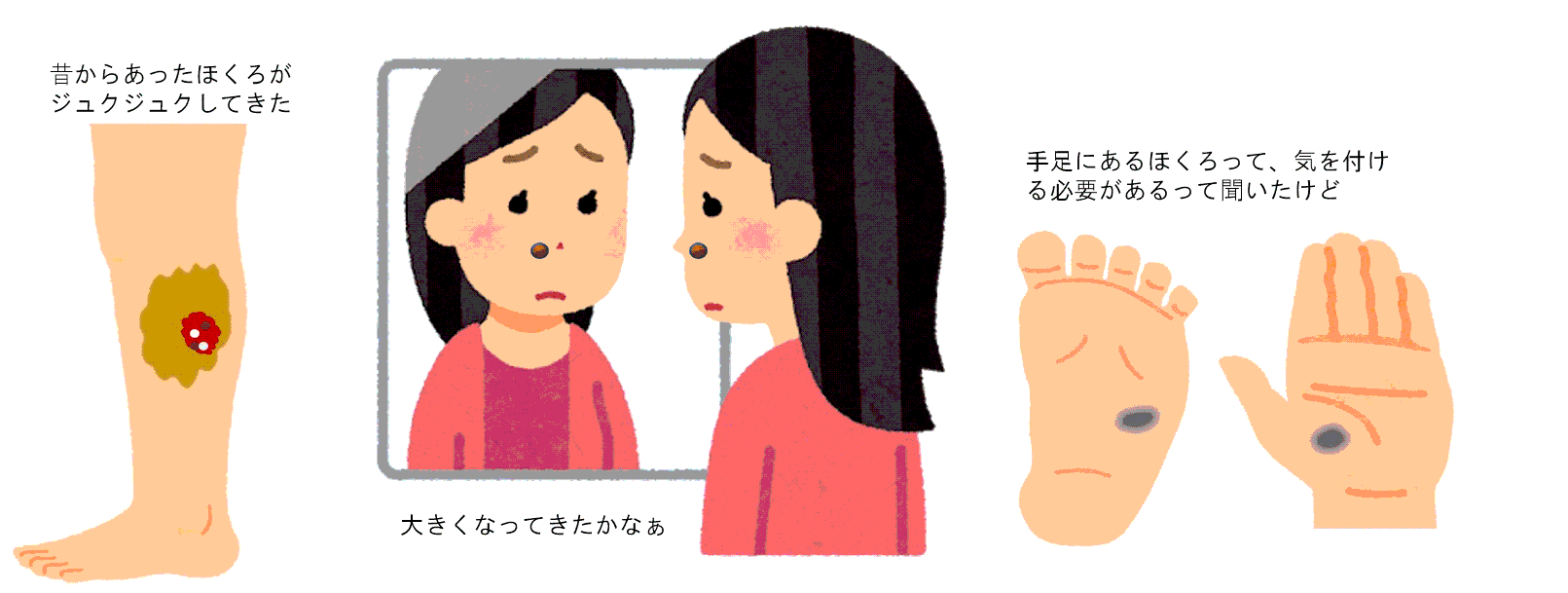 ほくろの診断と手術は？