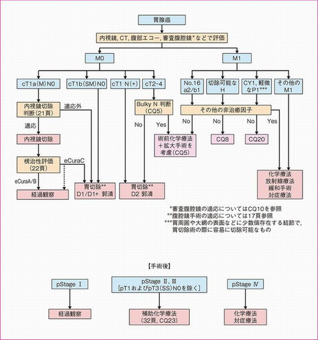 胃癌治療ガイドライン 治療方針のアルゴリズム