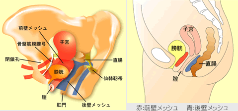 TVM法