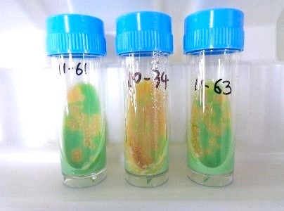 7.抗酸菌検査修正2