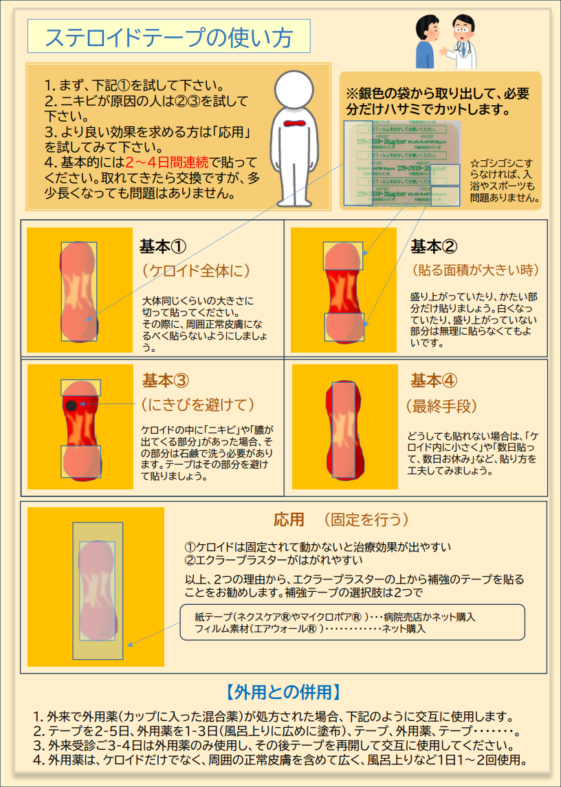 エクラープラスター（ステロイドテープ）と特殊軟膏の使い方