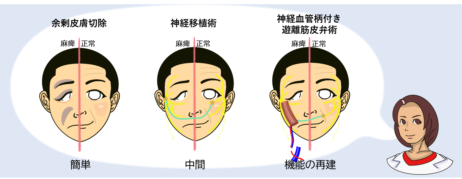 手術方法