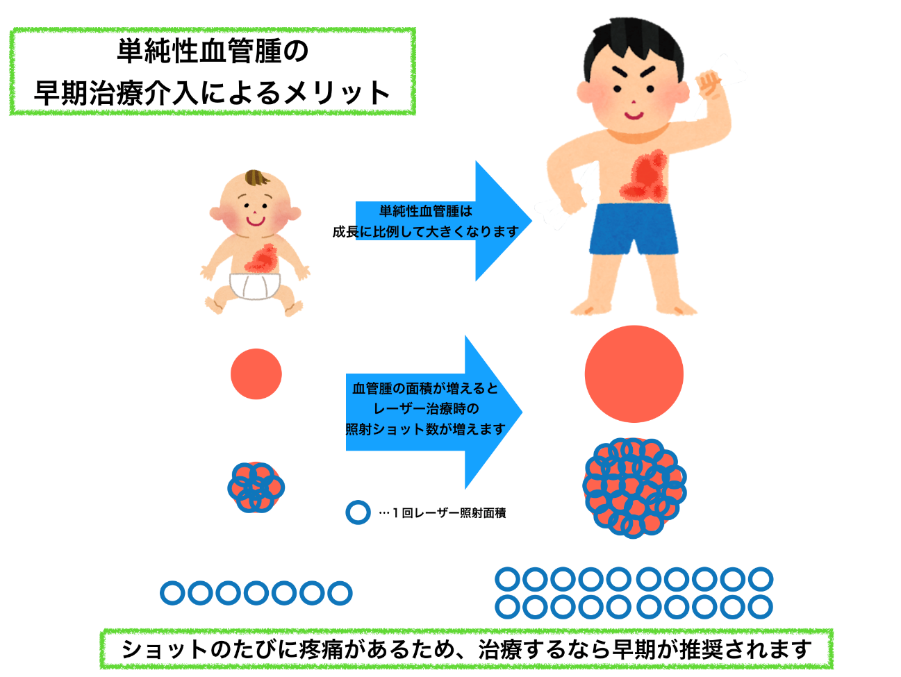 単純性血管腫4 単純性血管腫4