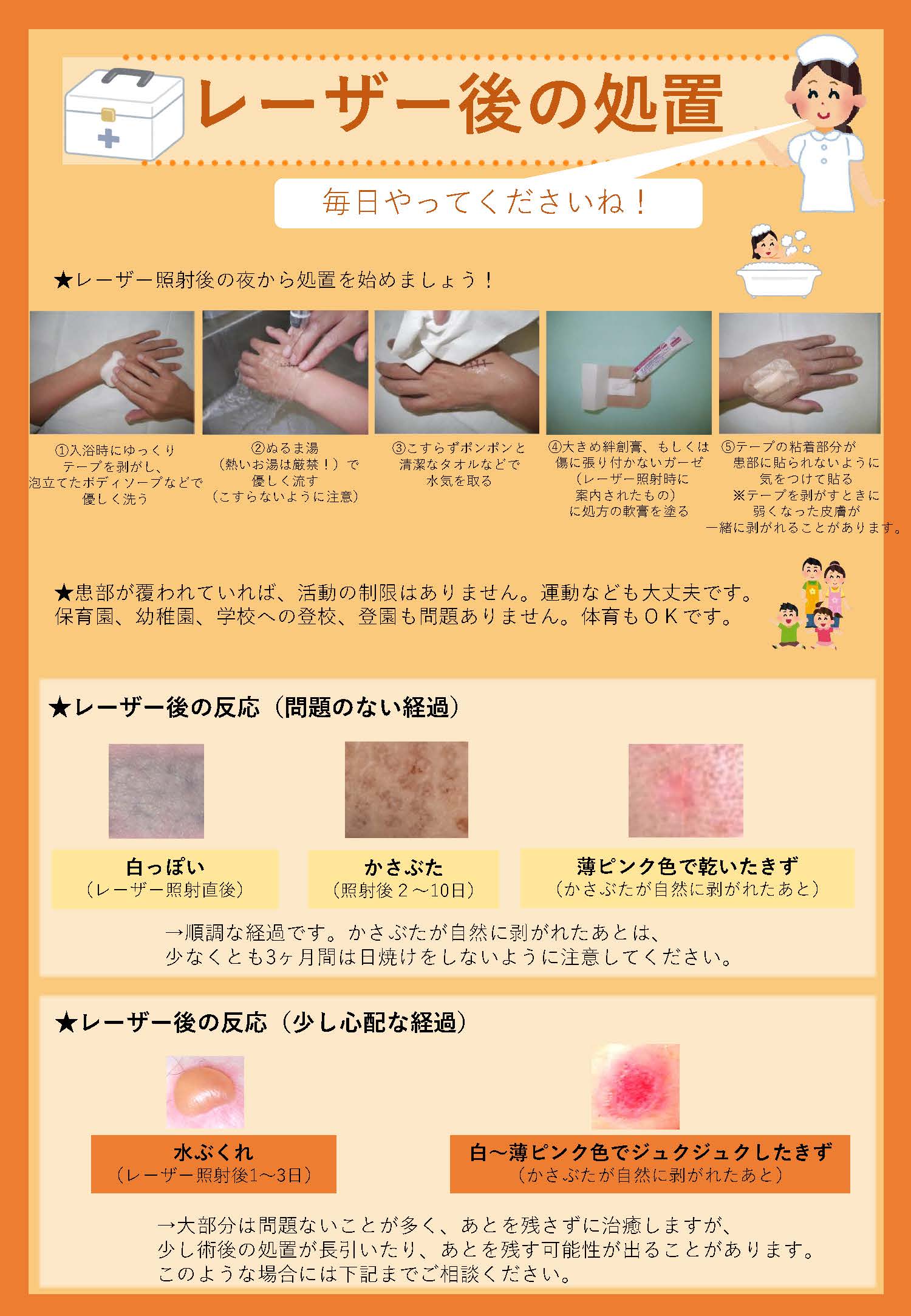 レーザー後の処置方法と注意事項 レーザー後の処置方法と注意事項