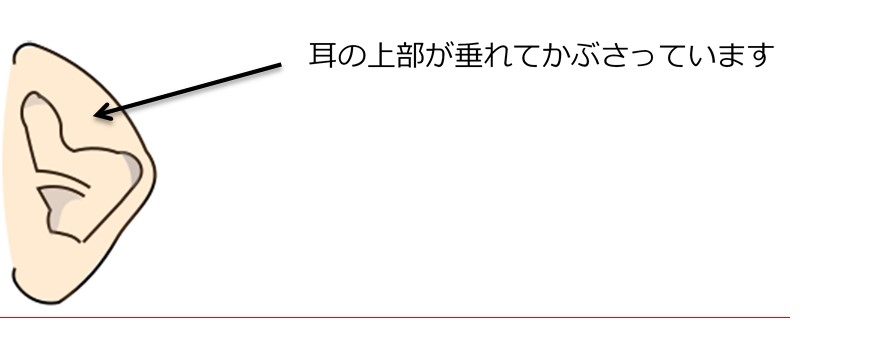 折れ耳 折れ耳