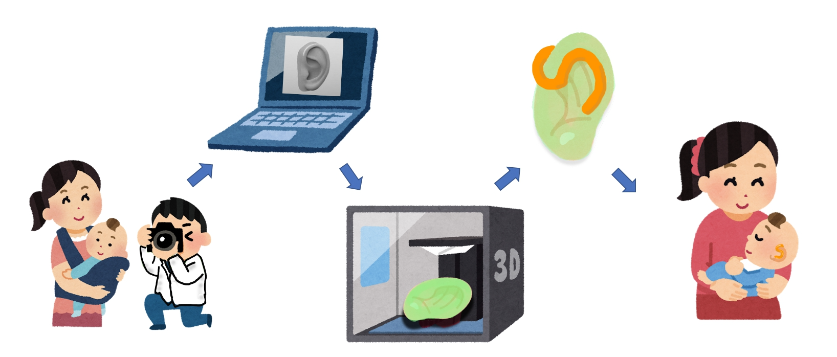 先天性耳介変形2(埋没耳や折れ耳)に対する早期治療 先天性耳介変形2(埋没耳や折れ耳)に対する早期治療