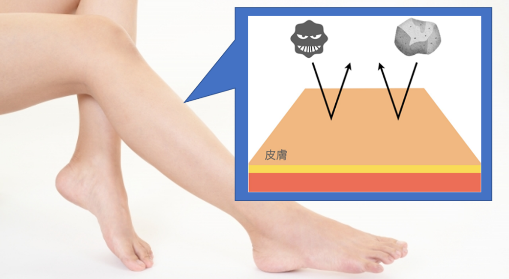 1皮膚潰瘍や糖尿病足病変(足壊疽)につける治療器械(局所陰圧閉鎖療法) 1皮膚潰瘍や糖尿病足病変(足壊疽)につける治療器械(局所陰圧閉鎖療法)