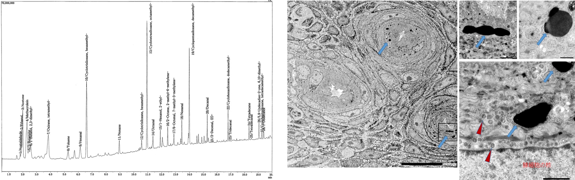 ワキガの研究 ワキガの研究
