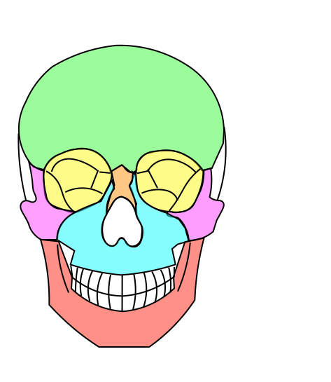 顔面骨折3 顔面骨折3