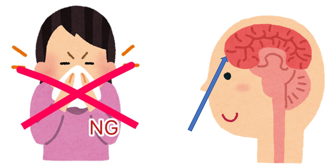 術後の注意点は? 術後の注意点は?