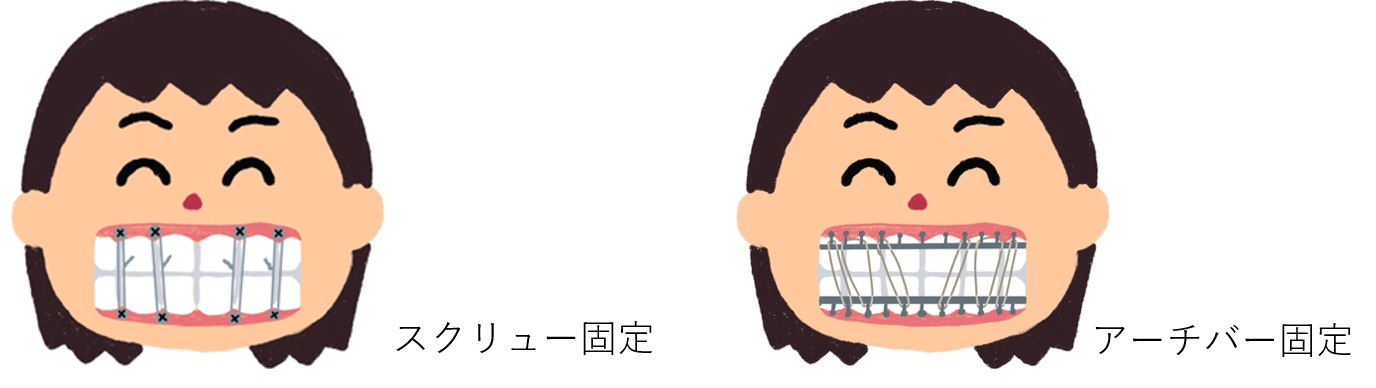 下顎骨6 下顎骨6