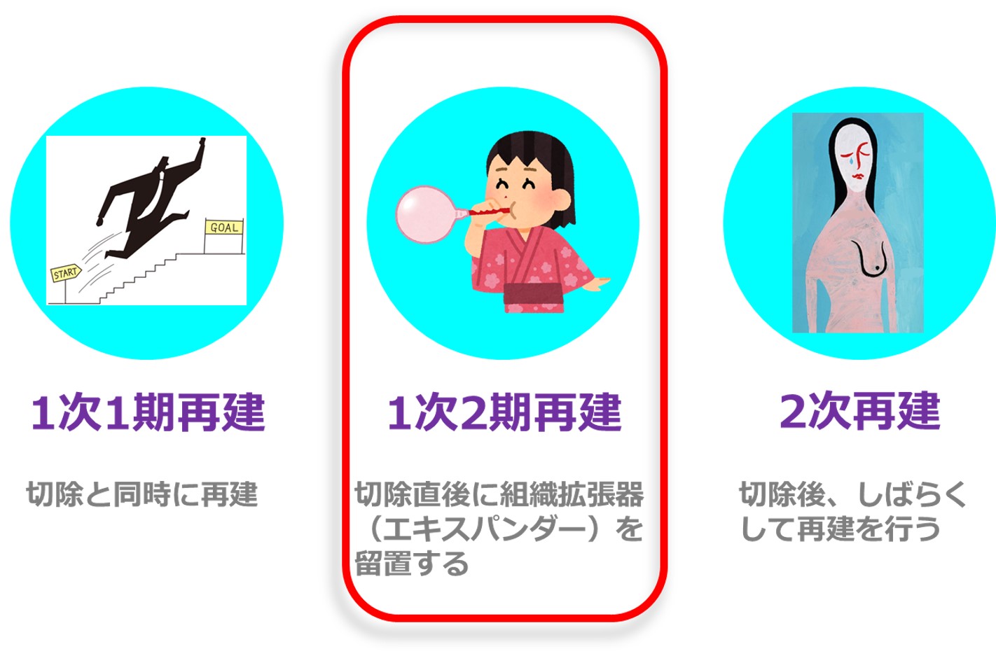 乳房再建の時期 乳房再建の時期